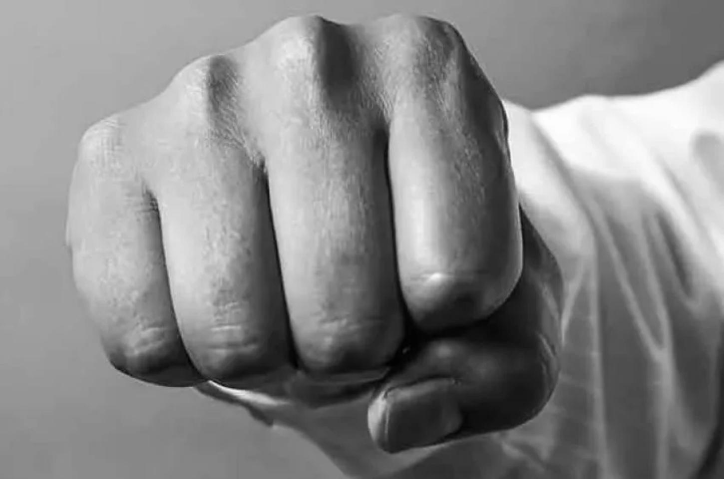 Homem de 28 anos foi agredido por três indivíduos com pedaços de madeira e ferro em Perobal