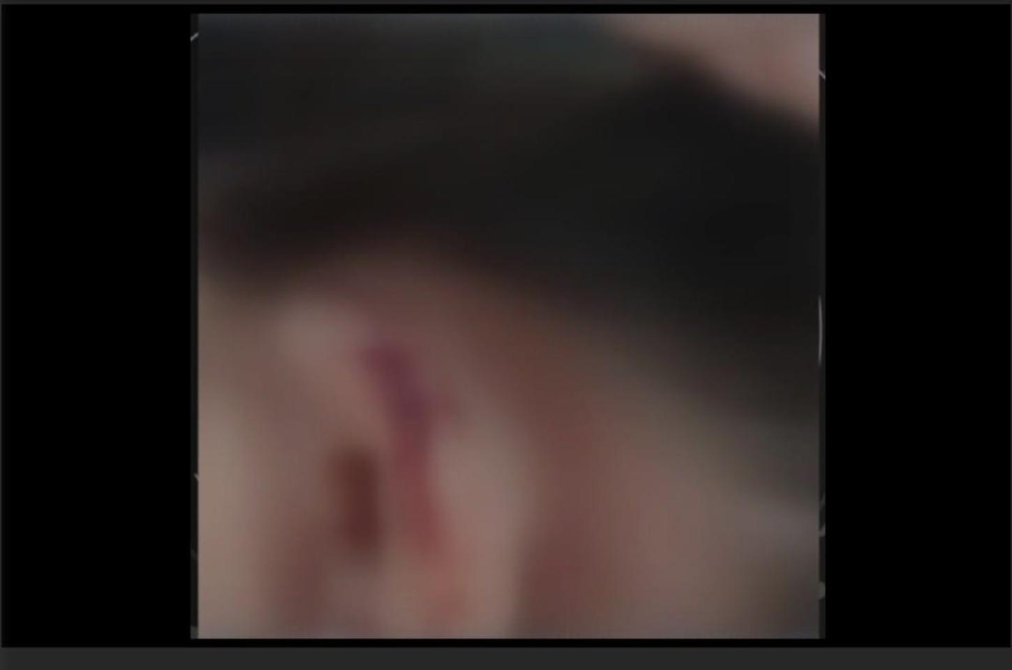 Técnica de enfermagem que agrediu crianças com agulha é indiciada por maus-tratos.