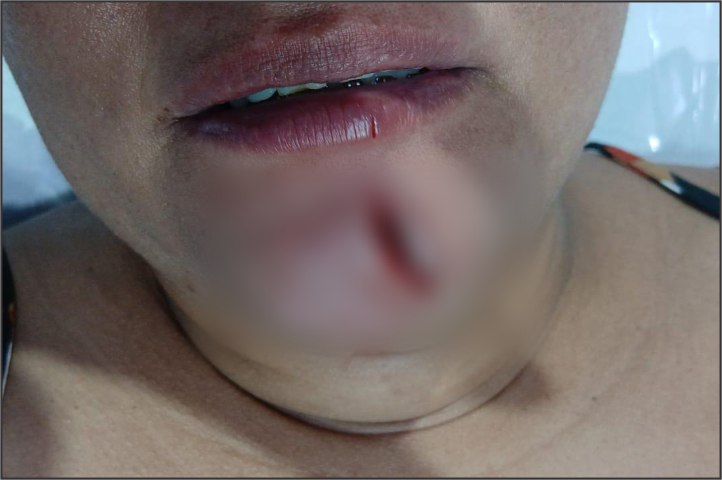 Mulher é presa após ferir irmã com faca e causar danos durante abordagem em Francisco Alves