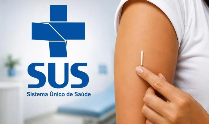 Implante contraceptivo Implanon passa a ser oferecido gratuitamente pelo SUS