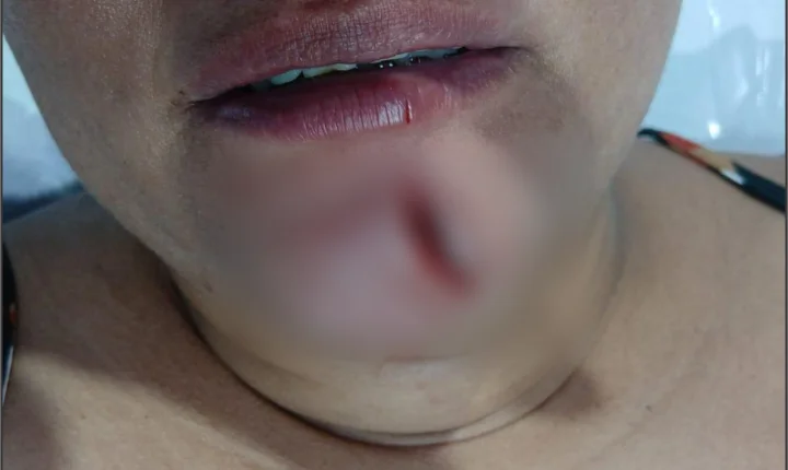 Mulher é presa após ferir irmã com faca e causar danos durante abordagem em Francisco Alves